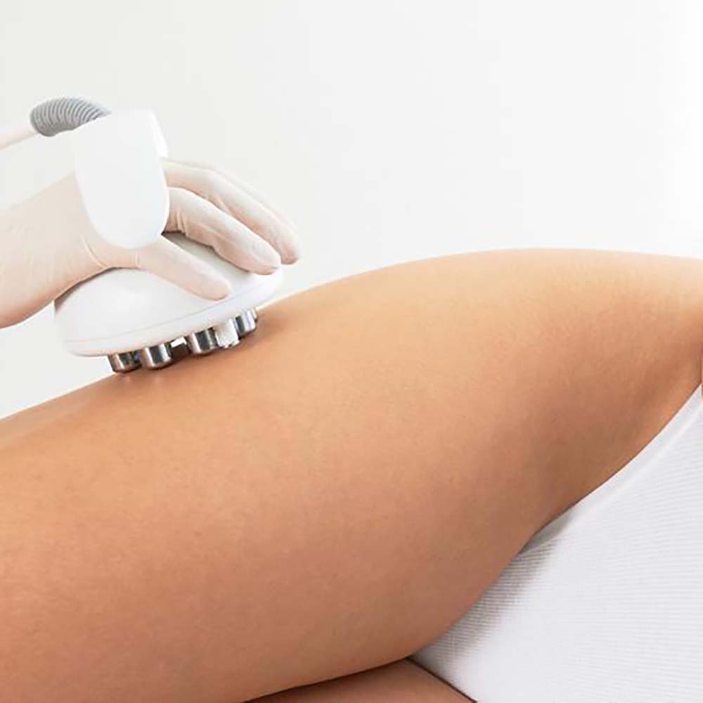 Anti-Cellulite-Body-Contouring-04