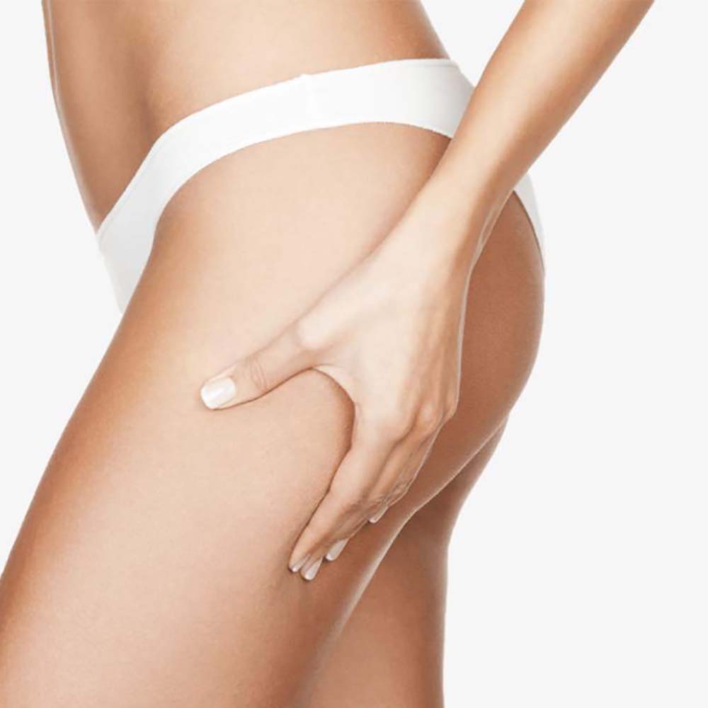 Anti-Cellulite-Body-Contouring-07