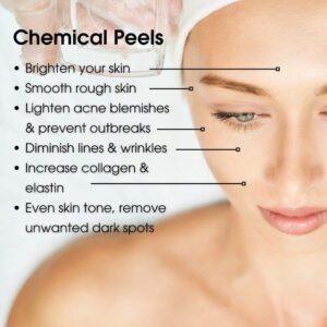 CHEMICAL-PEELS-01