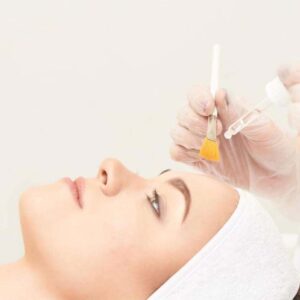 CHEMICAL-PEELS-02
