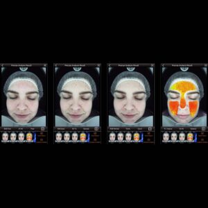 Digital skin analysis-02