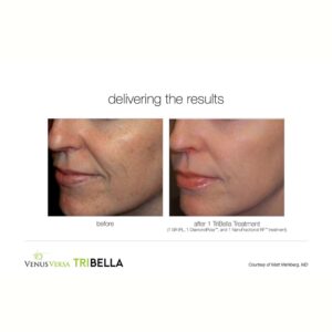 Tri-Bella-06