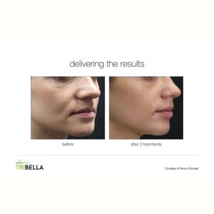 Tri-Bella-07