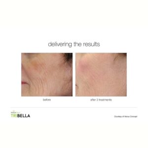 Tri-Bella-08