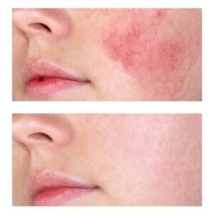 sensitive-skin-02