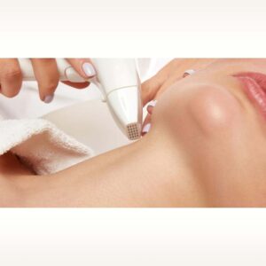 skin-resurfacing-01