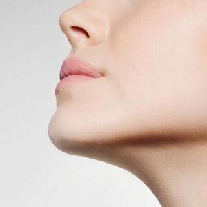 skin-resurfacing-02