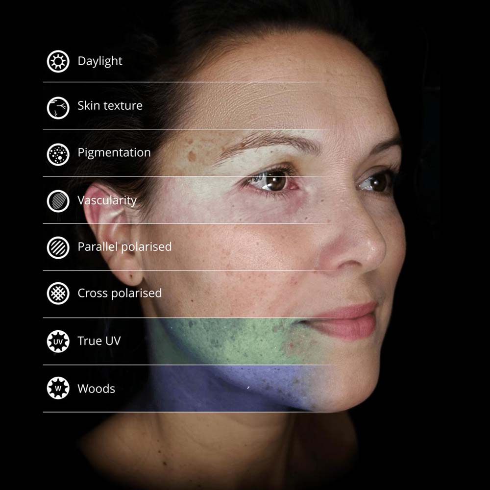Digital skin analysis01