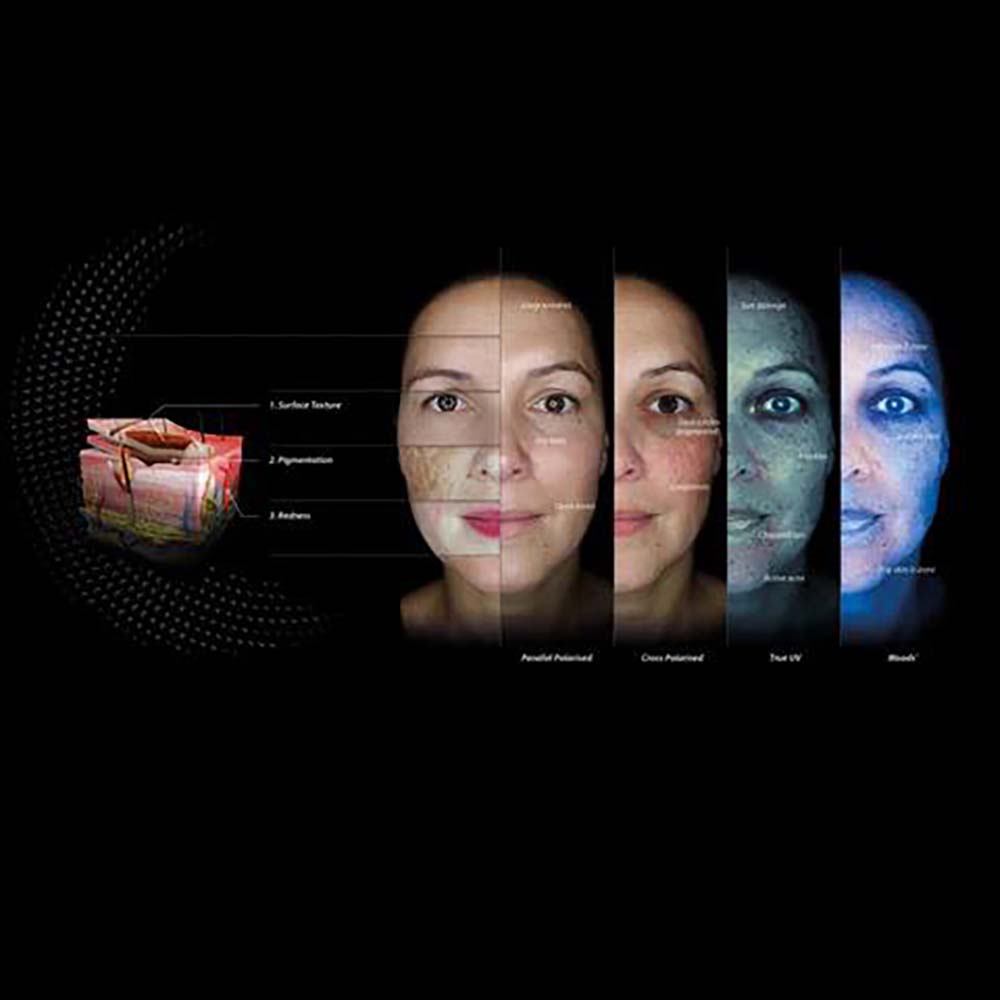 Digital skin analysis04