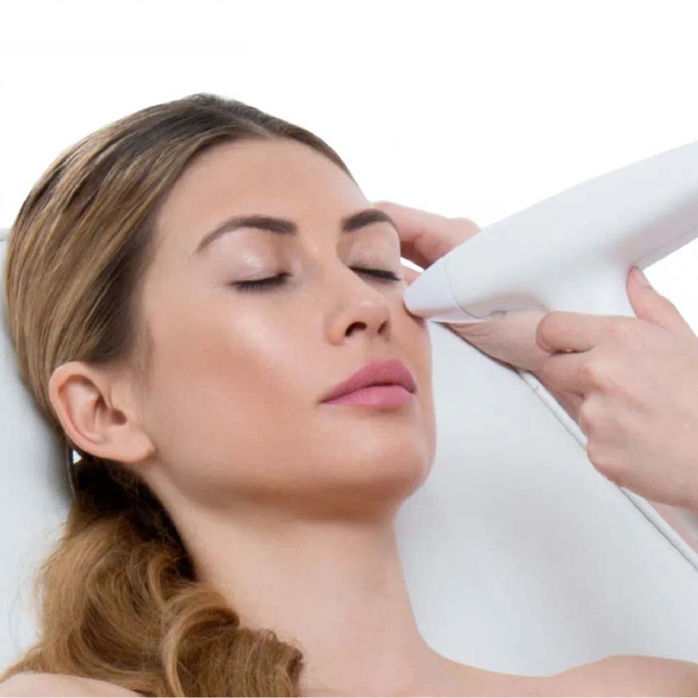 Skin resurfacing2