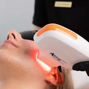 NIR skin tightening01